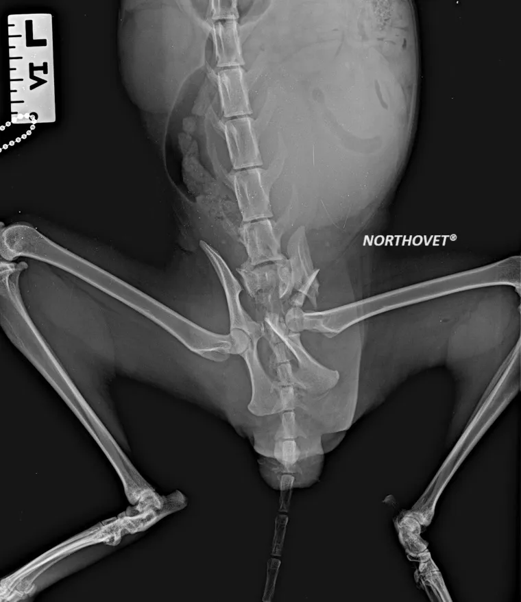 Botzuk πριν την χειρουργική επέμβαση